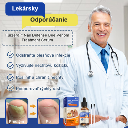 🐝🐝FurzeroTM Včelí jed na plesne na nechtoch: kompletné riešenie plesní na nechtoch 🌟👣