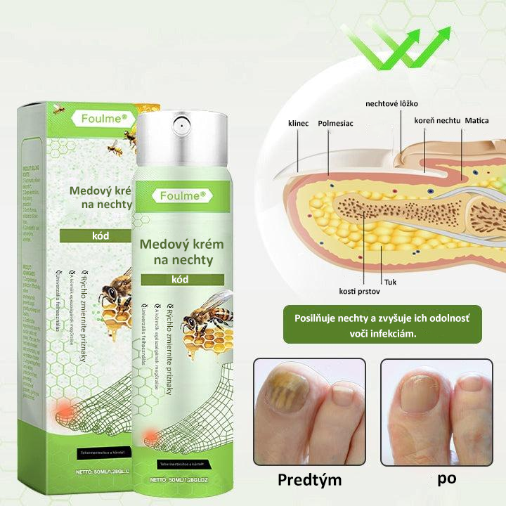Časovo obmedzená zľava 50 % | Sprej s včelím jedom Foulme® NailRescue🐝